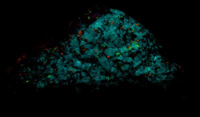 Fluorite "chlorophane", with minor franklinite, willemite and calcite, from the Buckwheat dump Franklin, NJ under shortwave UV Light