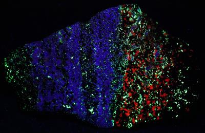 Hardystonite vein, willemite, calcite, and franklinite from Franklin, NJ under shortwave UV Light
